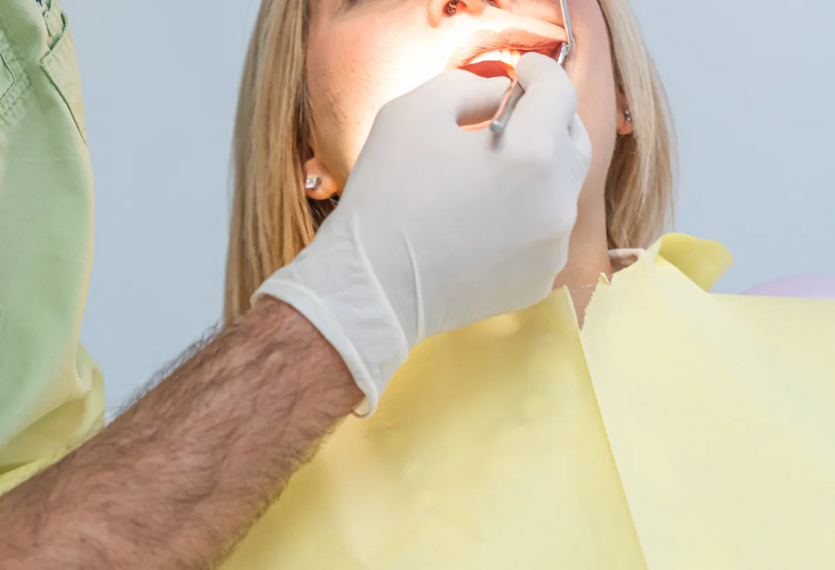 Preparazione conservativa · estetica dentale a Olbia