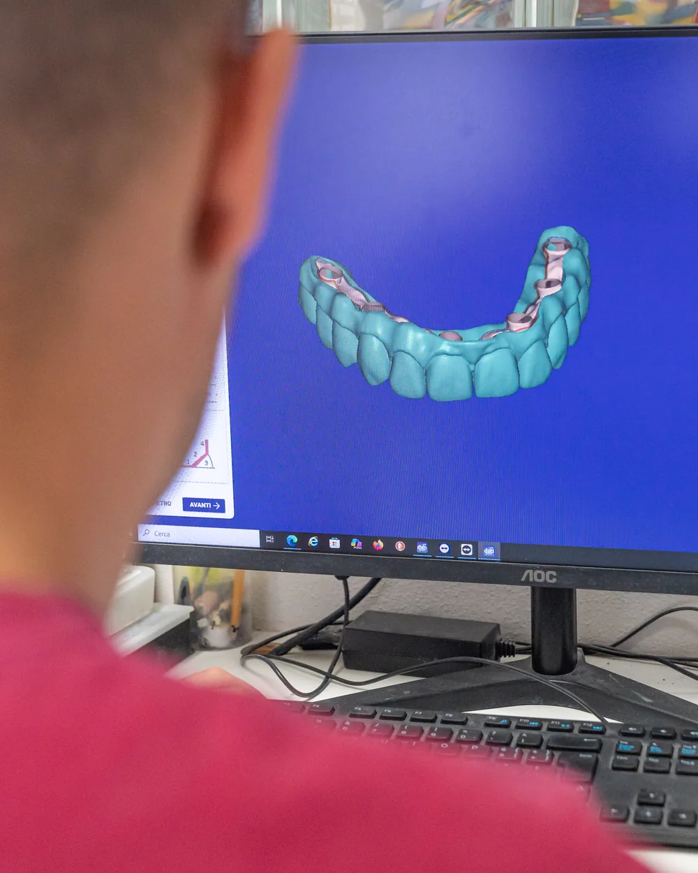 Operatore della Sardinia Dental Clinic esamina un modello 3D digitale della bocca su schermo, precisione diagnostica a Olbia