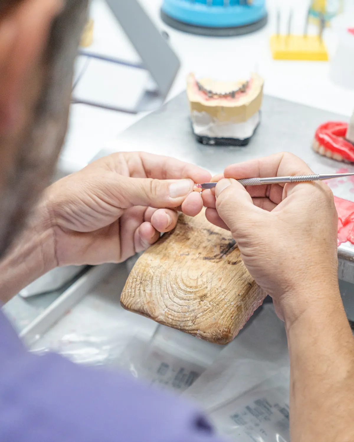 Il laboratorio odontotecnico interno
