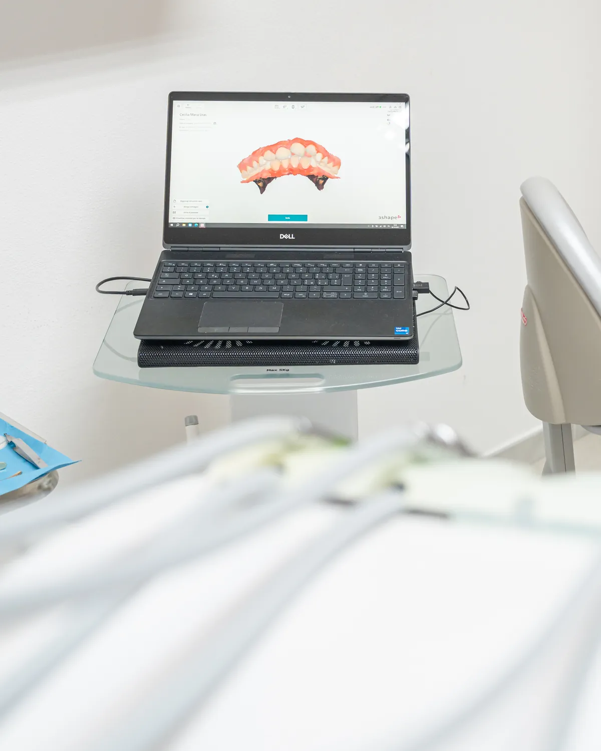 Impronta digitale con scanner intraorale per l'ortodonzia, Olbia