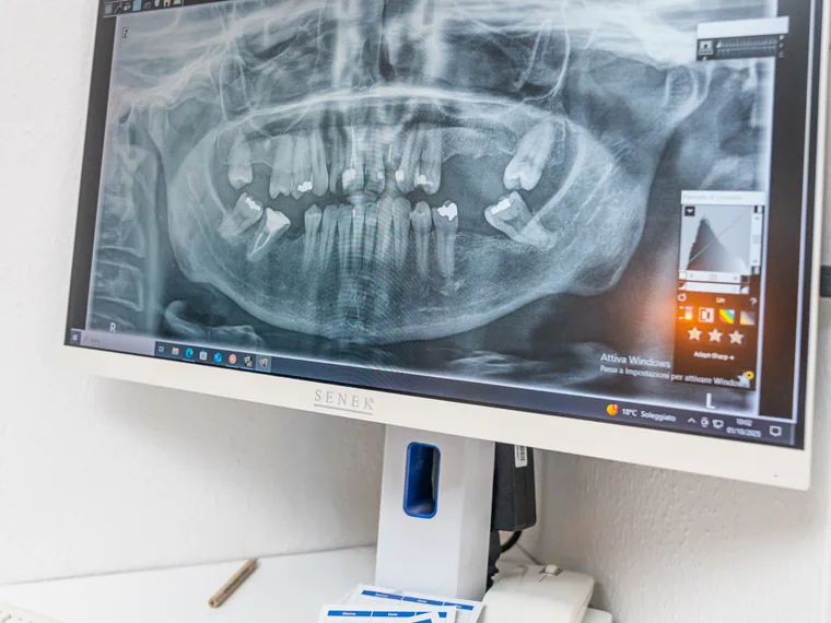 Controlli di crescita · odontoiatria pediatrica a Olbia