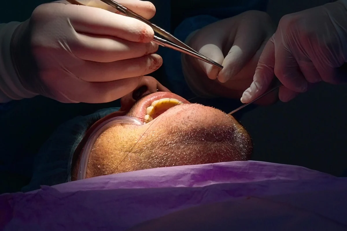 Chirurgia, se serve · parodontologia a Olbia