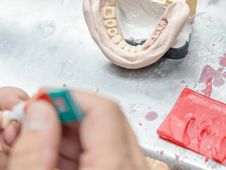Prova e adattamento di una protesi su misura alla Sardinia Dental Clinic di Olbia
